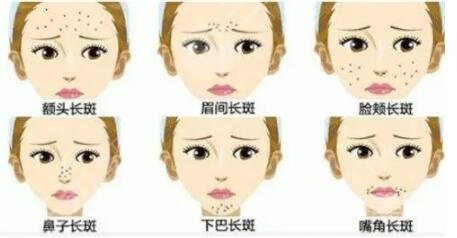 簡單的祛斑方法有哪幾種見效快?