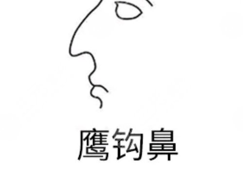 海鷗線和鷹鉤鼻的區(qū)別