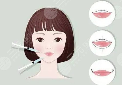 唇部注射玻尿酸需要注意什么？