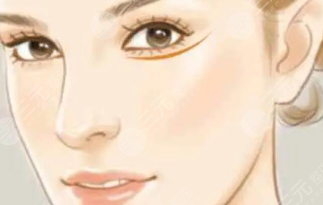 墊鼻梁有什么后遺癥和風(fēng)險(xiǎn)？要盡量避免文中4種癥狀，否則修復(fù)！