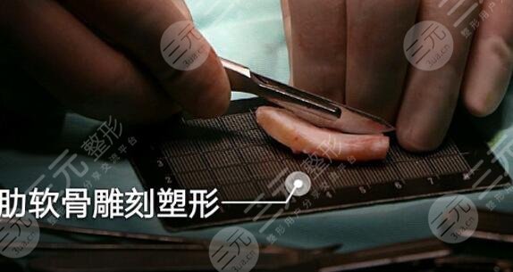 墊鼻梁哪種材料可靠?