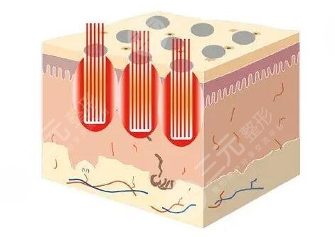 點(diǎn)陣像素激光是什么效果?