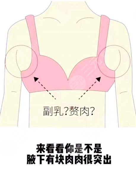 6大腋下副乳運(yùn)動(dòng)消除方法！4分鐘消除副乳！甩掉拜拜肉！