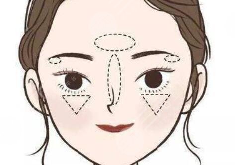 蘋(píng)果肌復(fù)位