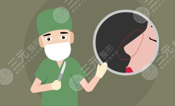 硅膠隆鼻前后對比效果差距明顯，直男看了都直呼‘側顏殺手’