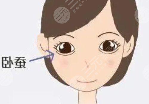 注射臥蠶后會(huì)變成眼袋嗎？