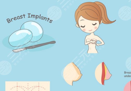 假體豐胸如何避免包膜痙攣？