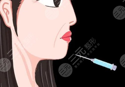 外輪廓固定提升有哪些手術(shù)方案?