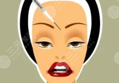 外輪廓固定提升有哪些手術(shù)方案?