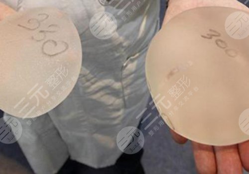 光面假體隆胸會移位嗎？