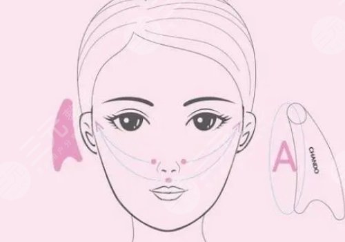 輪廓整形1個(gè)月和6個(gè)月對(duì)比圖