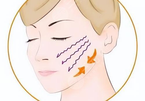 輪廓整形1個(gè)月和6個(gè)月對(duì)比圖