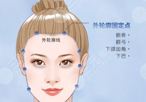 輪廓整形1個(gè)月和6個(gè)月對(duì)比圖