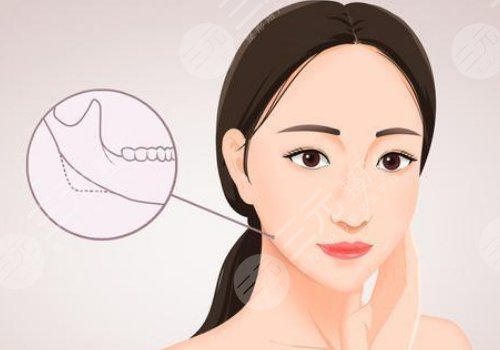 輪廓整形1個(gè)月和6個(gè)月對(duì)比圖