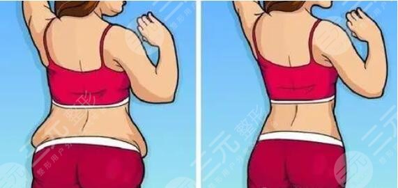 瘦腰豐胸運(yùn)動(dòng)有用嗎？常見的安全可靠的豐胸運(yùn)動(dòng)盤點(diǎn)！