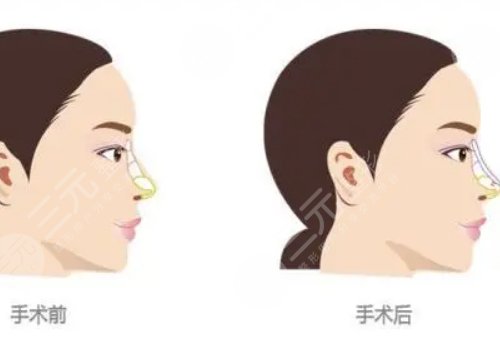 成都天之美的劉寧醫(yī)生怎么樣?