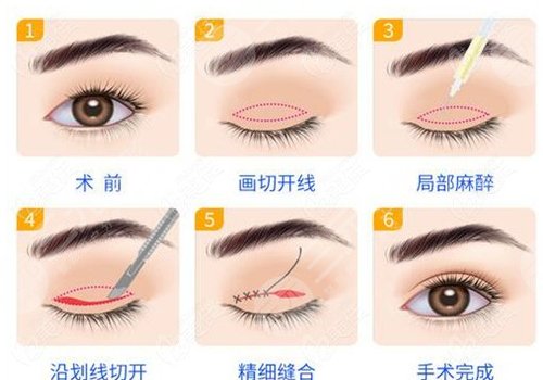 成都天之美的劉寧醫(yī)生怎么樣?