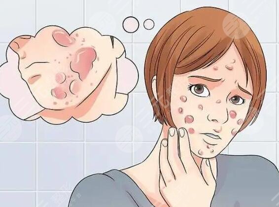 去痘印要多少錢一次？痘坑能修復(fù)嗎？怎么預(yù)防痘印？