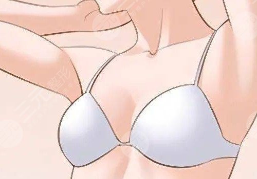 光面假體容易包膜攣縮嗎？會移位嗎？