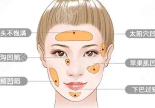 面部脂肪填充多久能恢復(fù)自然？