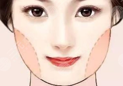 國字臉削骨手術(shù)風險大嗎？