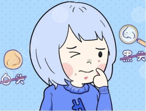 去黑頭有效的方法有哪些起效快速？5個好用的方法，一周一次