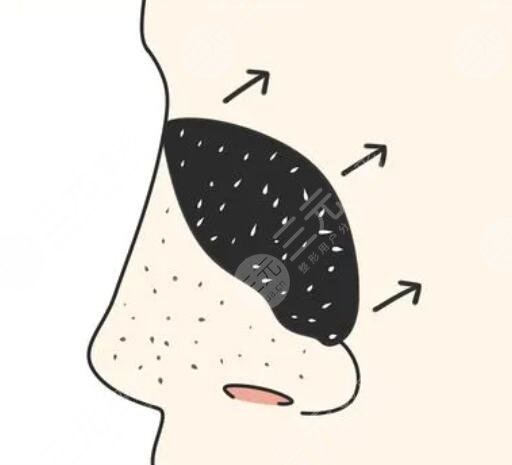 小氣泡深層清潔