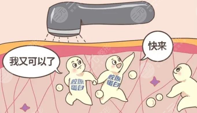 膠原蛋白填充臉部維持多久？