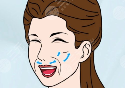 電波拉皮多久做一次合適？