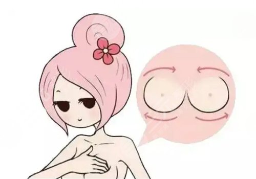 水滴形假體容易移位嗎?