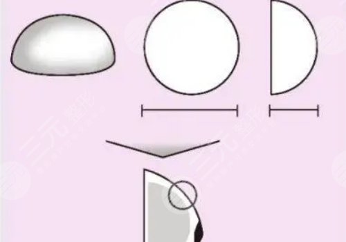 水滴形假體有光面的嗎？