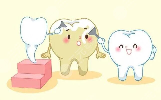 冷光牙齒美白的幾個步驟是什么?