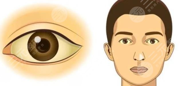 雙眼皮修復(fù)