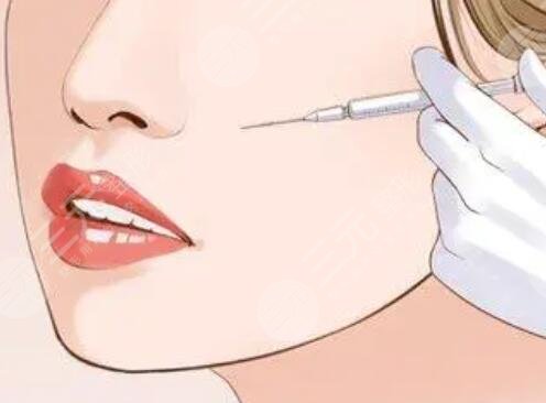 注射除皺的作用