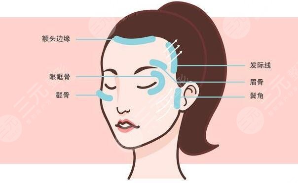 注射除皺的注意事項(xiàng)