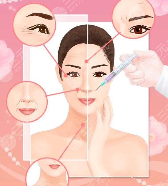 注射除皺的基本原理