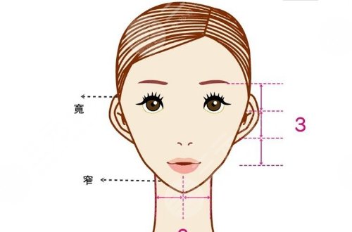 輪廓手術(shù)過程圖片|網(wǎng)友恢復(fù)案例