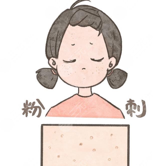 閉合性粉刺是什么樣的圖片