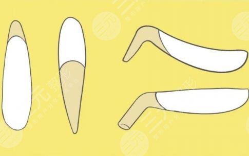 武漢張繼強(qiáng)擅長項(xiàng)目