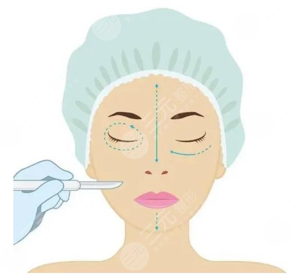 內切眼袋手術警惕三大后遺癥