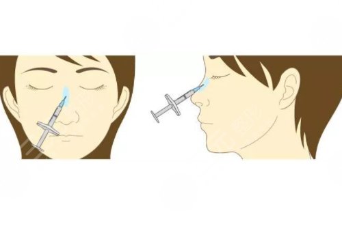 微創(chuàng)整形美容診療范圍有哪些？