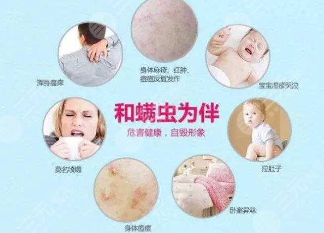 螨蟲(chóng)感染皮膚的癥狀