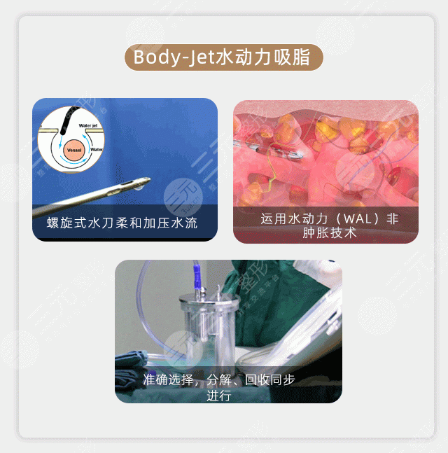 蝴蝶袖手臂吸脂多少錢？?jī)r(jià)格費(fèi)用更新！3家優(yōu)質(zhì)機(jī)構(gòu)分享~