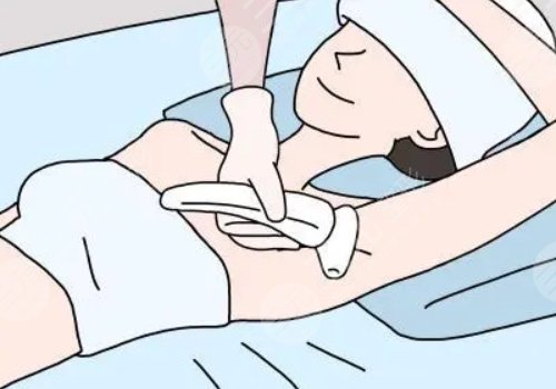 激光脫毛和冰點脫毛哪個好？