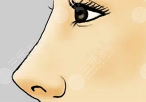 美國菲斯挺膨體適合放在鼻子哪里？