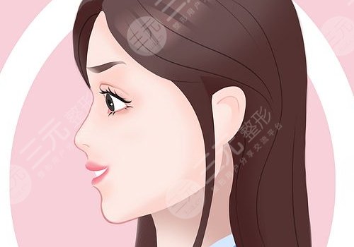 打玻尿酸隆鼻子有副作用嗎？