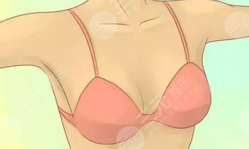 強(qiáng)生傲諾拉和曼托區(qū)別在哪？