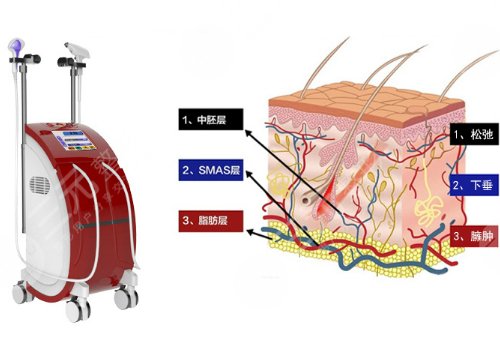 黃金熱拉提2.0做一次能維持多久？
