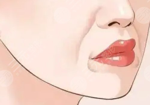 黃金熱拉提2.0做一次能維持多久？