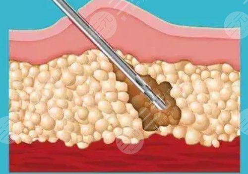 如何有效減肥不反彈？